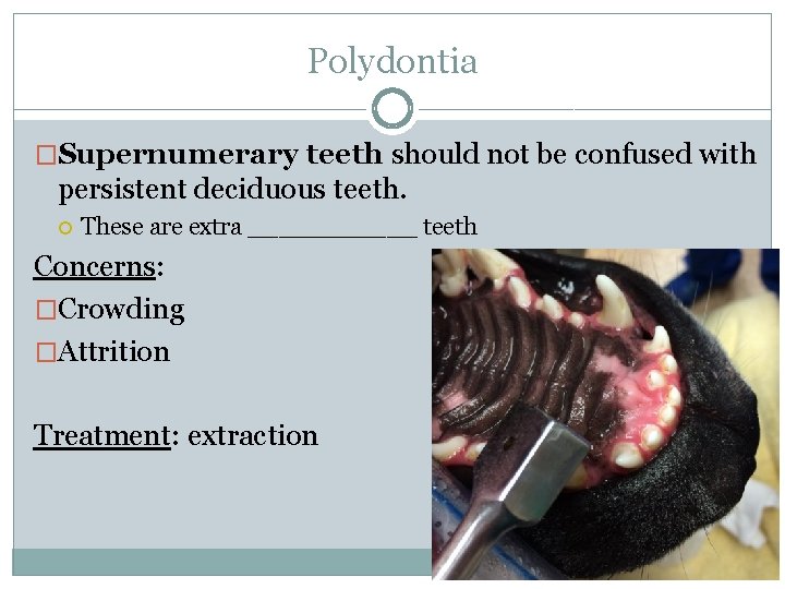 Polydontia �Supernumerary teeth should not be confused with persistent deciduous teeth. These are extra