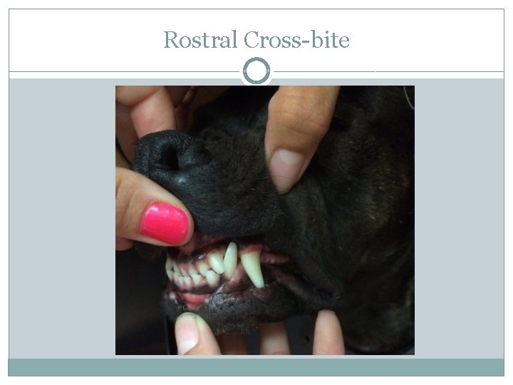 Rostral Cross-bite 