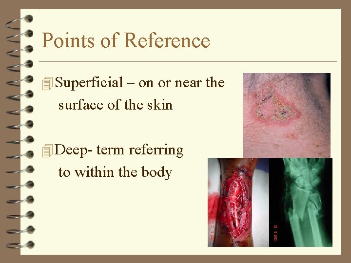 Points of Reference 4 Superficial – on or near the surface of the skin