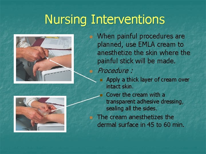Nursing Interventions n n When painful procedures are planned, use EMLA cream to anesthetize Nursing Interventions n n When painful procedures are planned, use EMLA cream to anesthetize