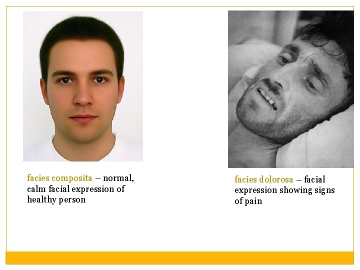 facies composita – normal, calm facial expression of healthy person facies dolorosa – facial