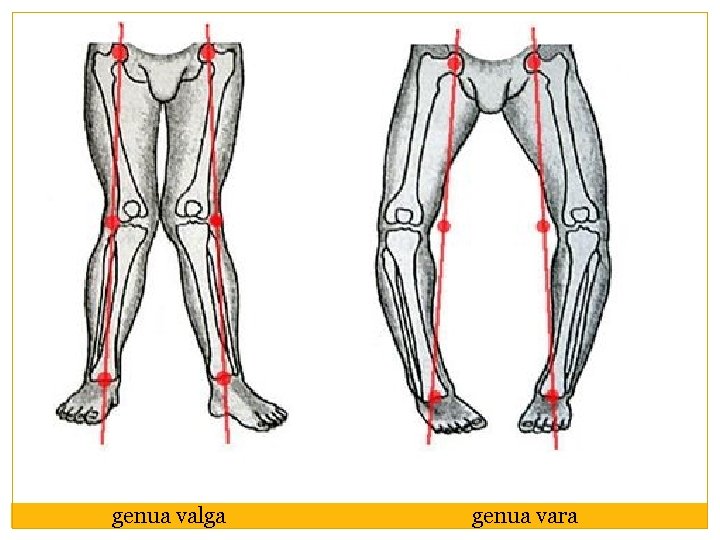 genua valga genua vara 