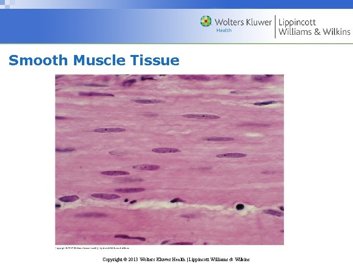 Smooth Muscle Tissue Copyright © 2013 Wolters Kluwer Health | Lippincott Williams & Wilkins