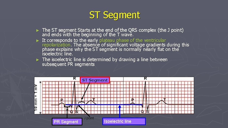 ST Segment The ST segment Starts at the end of the QRS complex (the ST Segment The ST segment Starts at the end of the QRS complex (the