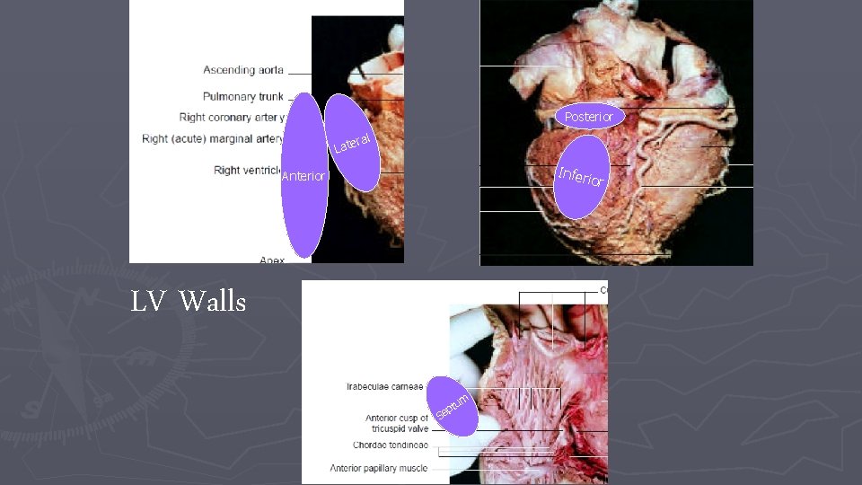 Posterior ral Late Infer Anterior LV Walls S m tu p e Posterior ral Late Infer Anterior LV Walls S m tu p e