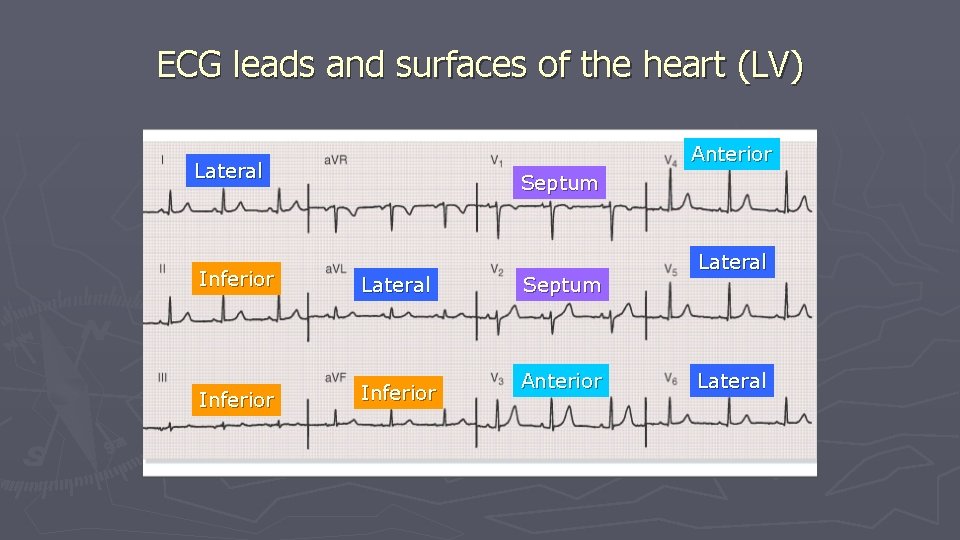 ECG leads and surfaces of the heart (LV) Anterior Lateral Septum Inferior Lateral Inferior ECG leads and surfaces of the heart (LV) Anterior Lateral Septum Inferior Lateral Inferior