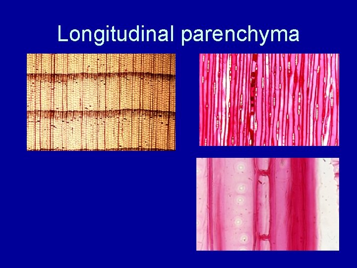 Longitudinal parenchyma 