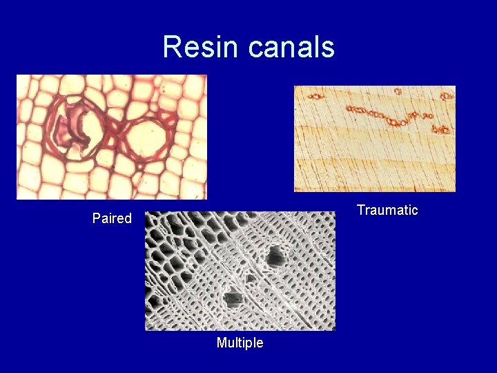 Resin canals Traumatic Paired Multiple 