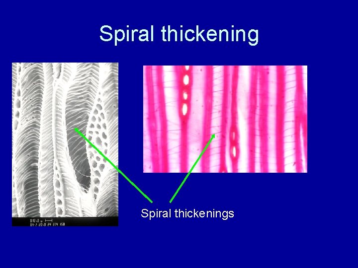 Spiral thickenings 