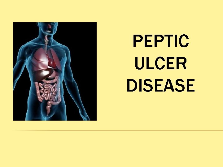 PEPTIC ULCER DISEASE 