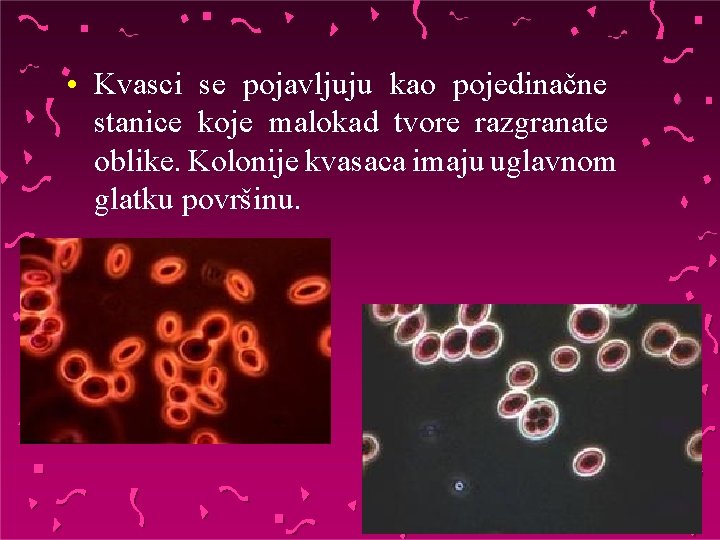  • Kvasci se pojavljuju kao pojedinačne stanice koje malokad tvore razgranate oblike. Kolonije