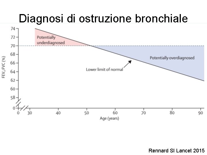 Diagnosi di ostruzione bronchiale Rennard SI Lancet 2015 