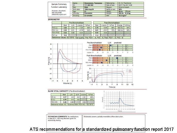 ATS recommendations for a standardized pulmonary function report 2017 