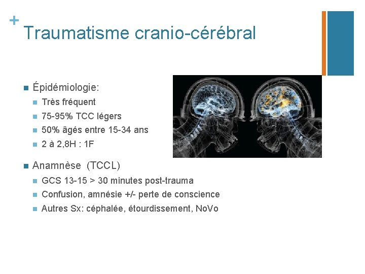 + Traumatisme cranio-cérébral n n Épidémiologie: n Très fréquent n 75 -95% TCC légers