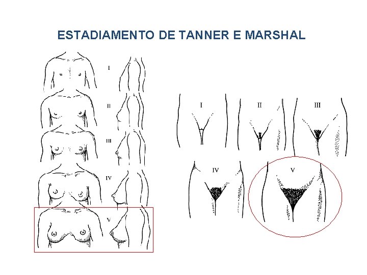 ESTADIAMENTO DE TANNER E MARSHAL 