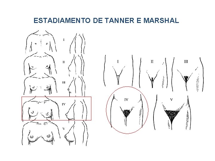 ESTADIAMENTO DE TANNER E MARSHAL 