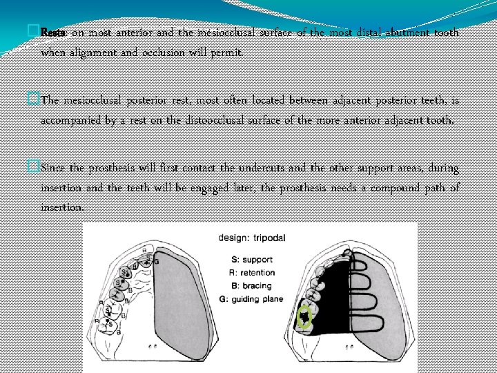 �Rests: on most anterior and the mesiocclusal surface of the most distal abutment tooth
