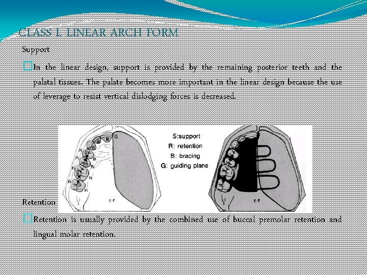 CLASS I. LINEAR ARCH FORM Support �In the linear design, support is provided by