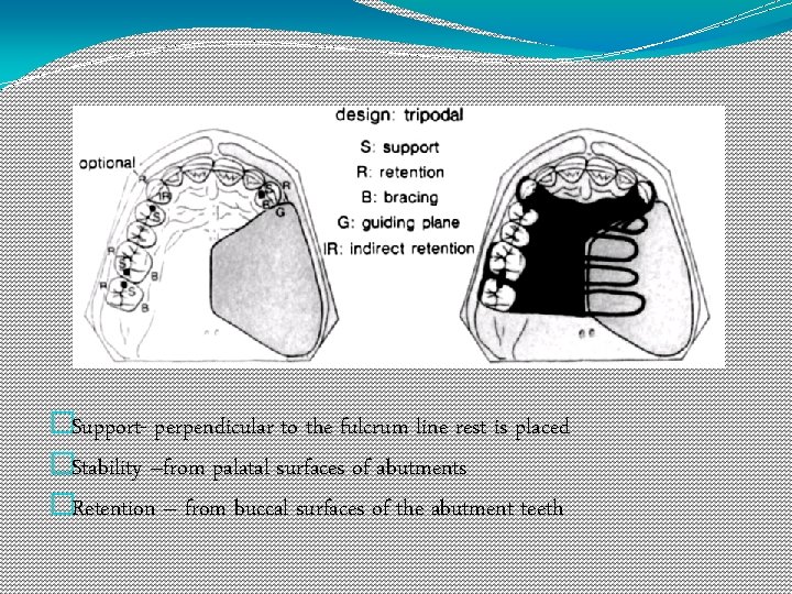 �Support- perpendicular to the fulcrum line rest is placed �Stability –from palatal surfaces of