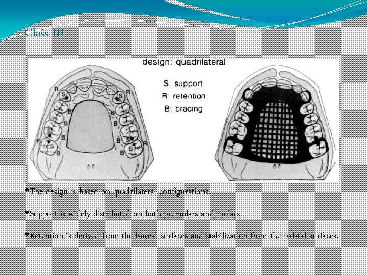 Class III • The design is based on quadrilateral configurations. • Support is widely