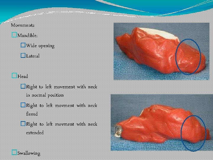 Movements �Mandible: �Wide opening �Lateral �Head �Right to left movement with neck in normal