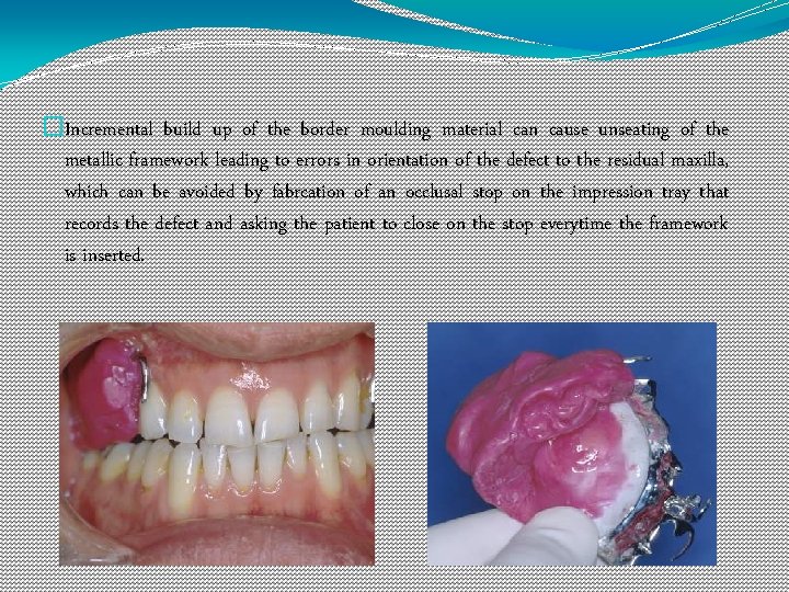 �Incremental build up of the border moulding material can cause unseating of the metallic