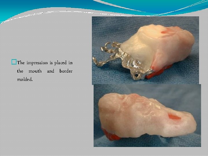 �The impression is placed in the mouth and border molded. 