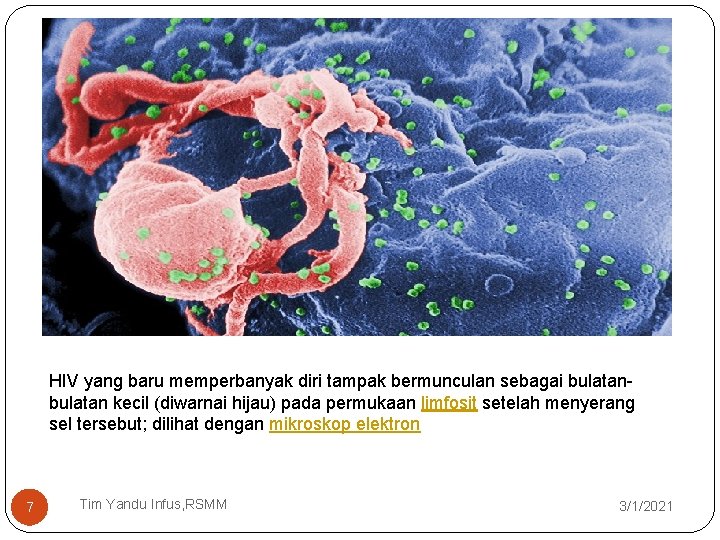 HIV yang baru memperbanyak diri tampak bermunculan sebagai bulatan kecil (diwarnai hijau) pada permukaan