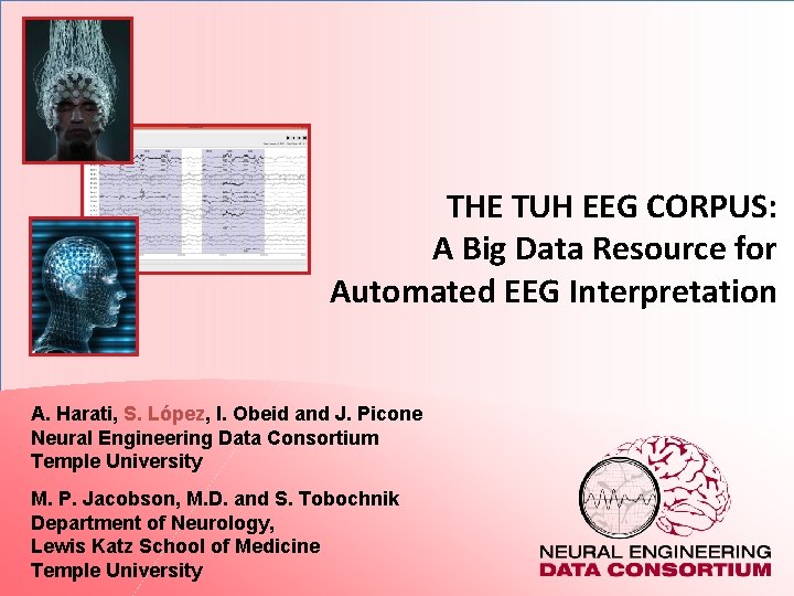 THE TUH EEG CORPUS: A Big Data Resource for Automated EEG Interpretation A. Harati,