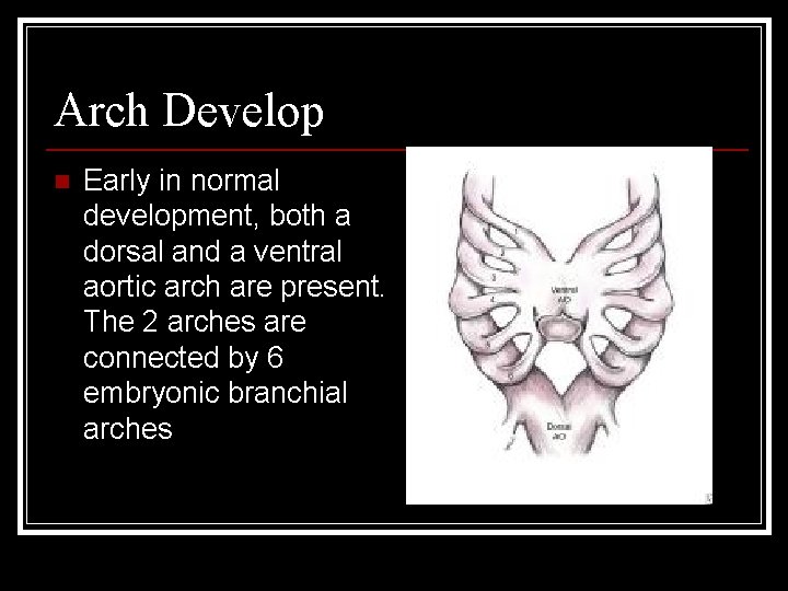 Arch Develop n Early in normal development, both a dorsal and a ventral aortic