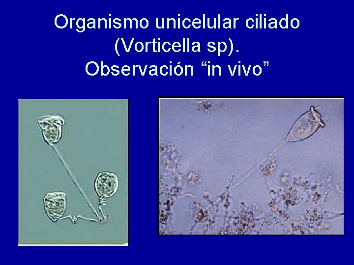 Organismo unicelular ciliado (Vorticella sp). Observación “in vivo” 
