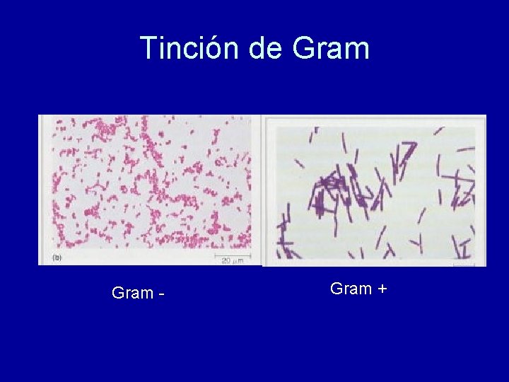 Tinción de Gram - Gram + 