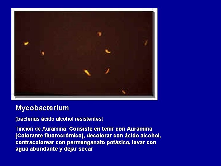 Mycobacterium (bacterias ácido alcohol resistentes) Tinción de Auramina: Consiste en teñir con Auramina (Colorante
