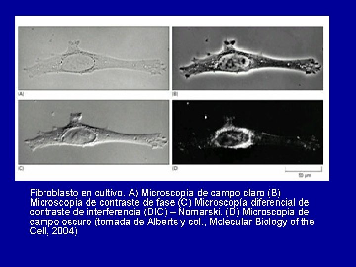 Fibroblasto en cultivo. A) Microscopía de campo claro (B) Microscopía de contraste de fase