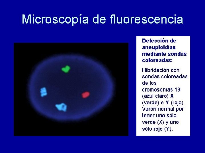 Microscopía de fluorescencia 