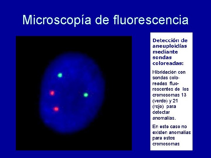 Microscopía de fluorescencia 