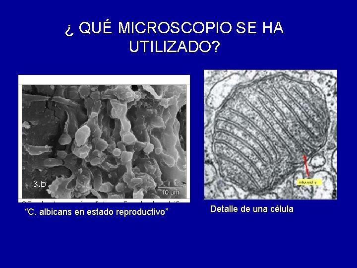 ¿ QUÉ MICROSCOPIO SE HA UTILIZADO? “C. albicans en estado reproductivo” Detalle de una