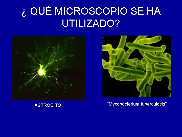¿ QUÉ MICROSCOPIO SE HA UTILIZADO? ASTROCITO “Mycobacterium tuberculosis” 