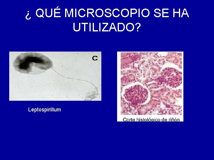 ¿ QUÉ MICROSCOPIO SE HA UTILIZADO? Leptospirillum 