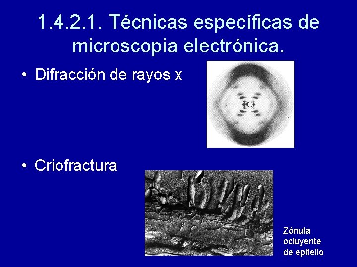 1. 4. 2. 1. Técnicas específicas de microscopia electrónica. • Difracción de rayos x