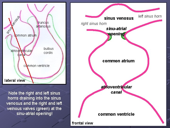 os us sinus venosus sin u s v en truncus arteriosus right sinus horn