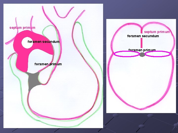 septum primum foramen secundum foramen primum 