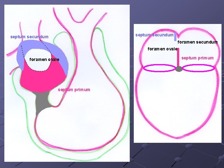 septum secundum foramen ovale septum primum 