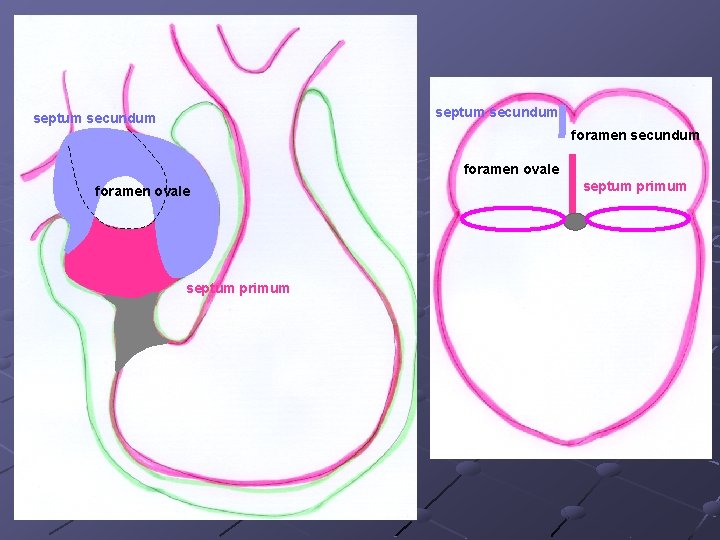 septum secundum foramen ovale septum primum 