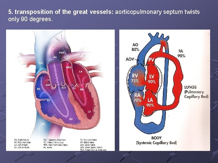 5. transposition of the great vessels: aorticopulmonary septum twists only 90 degrees. 