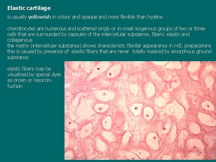 Elastic cartilage is usually yellowish in colour and opaque and more flexible than hyaline