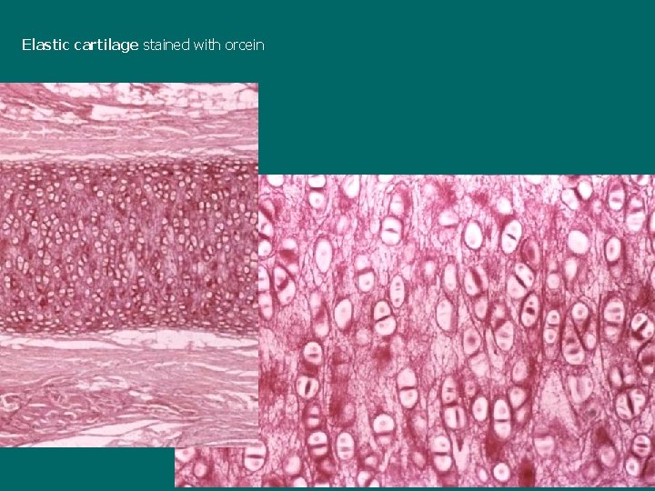 Elastic cartilage stained with orcein 