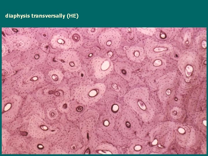diaphysis transversally (HE) 