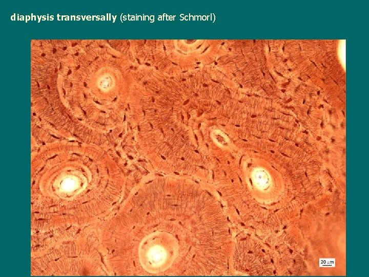 diaphysis transversally (staining after Schmorl) 