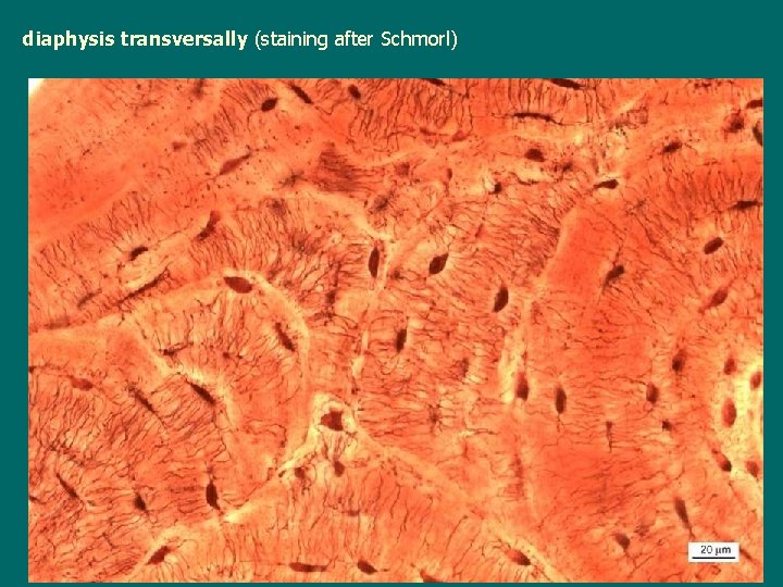 diaphysis transversally (staining after Schmorl) 